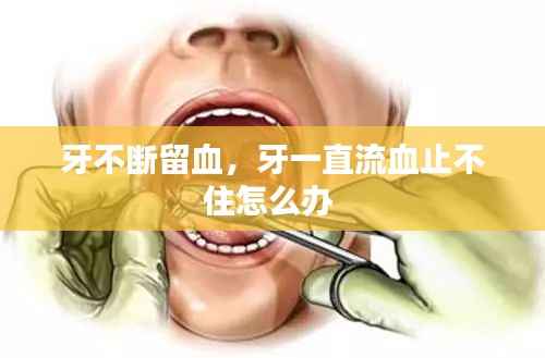 牙不断留血,牙一直流血止不住怎么办
