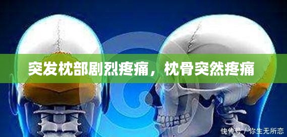 突发枕部剧烈疼痛,枕骨突然疼痛