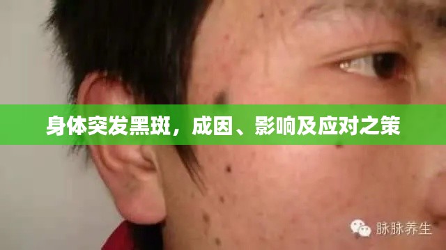 身体突发黑斑,成因、影响及应对之策